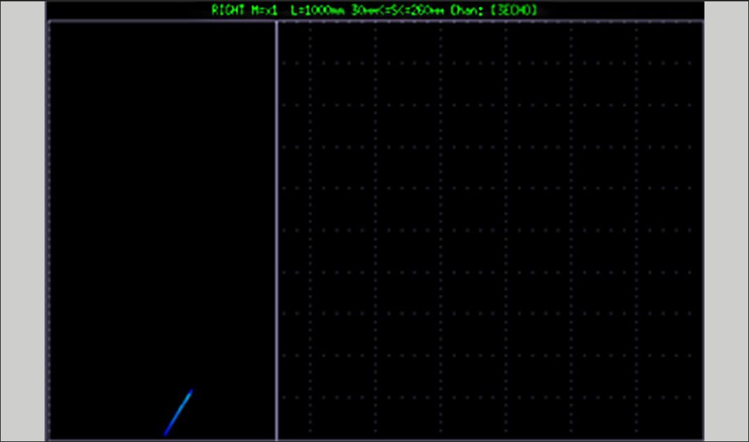 Ultrasonic B-scan showing corrosion-related metal loss