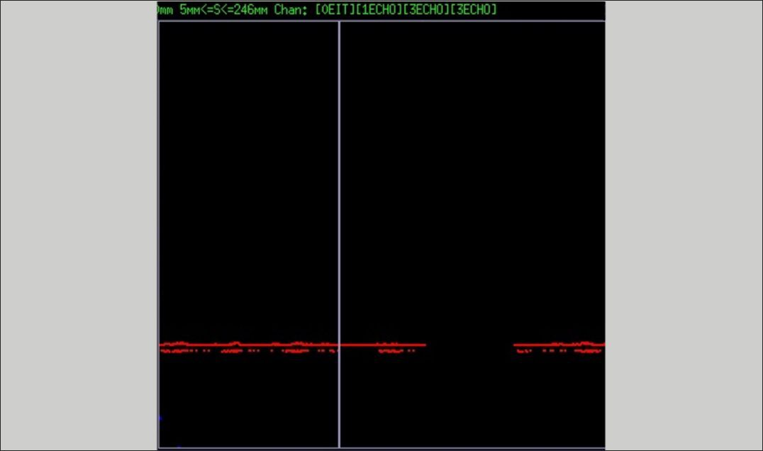 Ultrasonic B-scan display with reduced backwall signal from vertical crack
